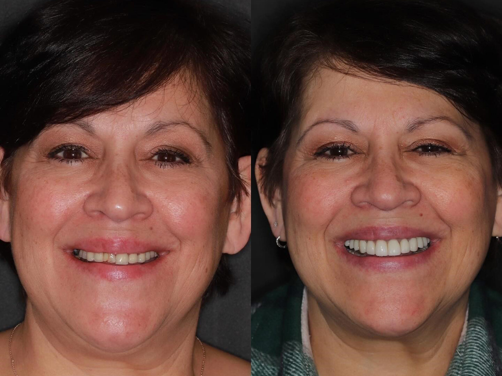 Michelle before and after