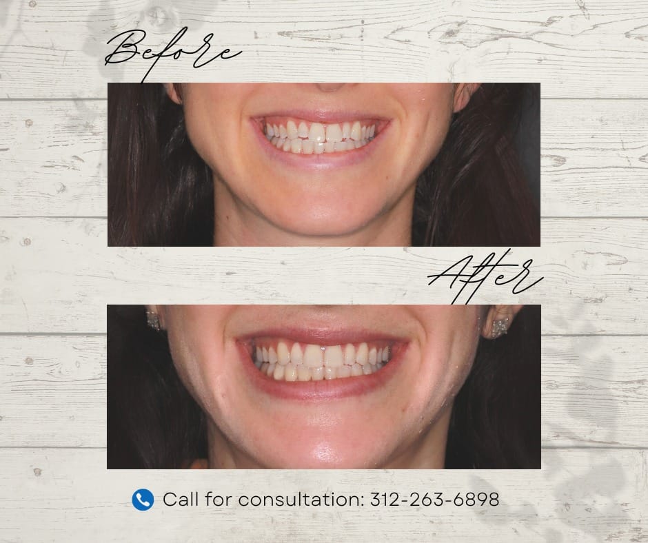 Dental transformation before and after