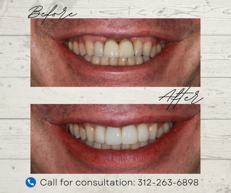 Dental transformation before and after