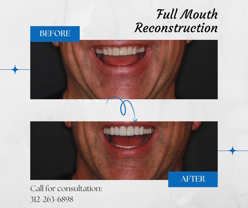 Dental transformation before and after